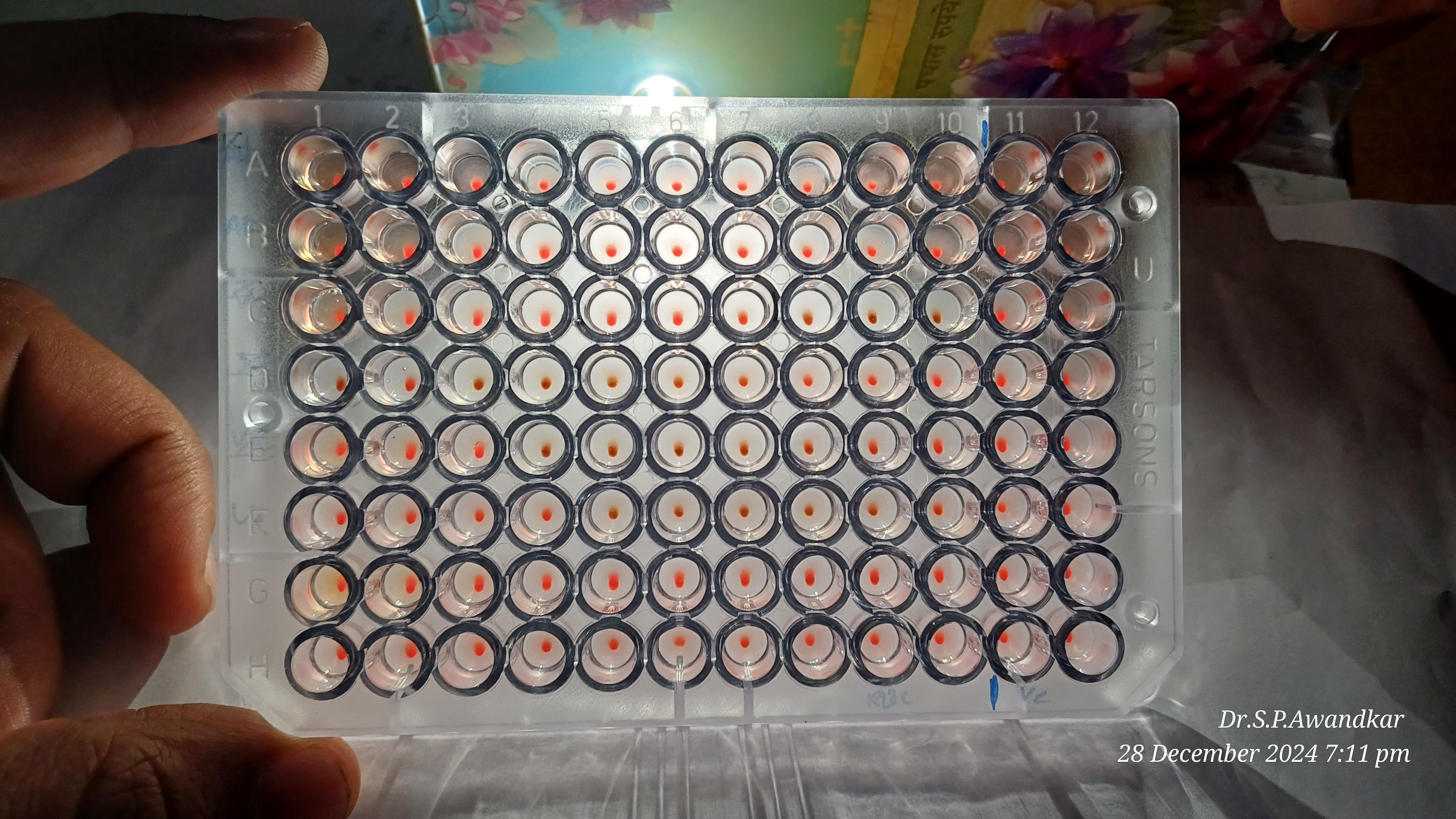 44. Haemagglutination Inhibition Test